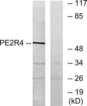 EP4 rabbit pAb Antibody