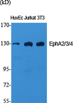 EphA2/3/4 rabbit pAb Antibody
