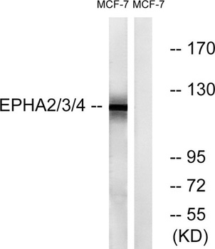 EphA2/3/4 rabbit pAb Antibody