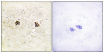 EphB1/2 rabbit pAb Antibody