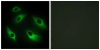EphB6 rabbit pAb Antibody