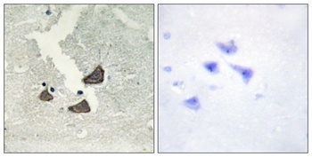 EphB6 rabbit pAb Antibody