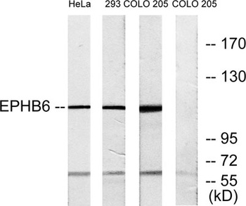 EphB6 rabbit pAb Antibody