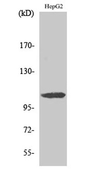 ERAP1 rabbit pAb Antibody