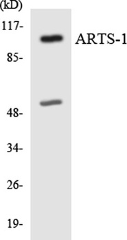 ERAP1 rabbit pAb Antibody