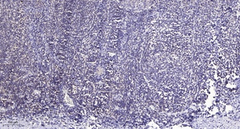 ERAP1 rabbit pAb Antibody
