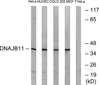 ERdj3 rabbit pAb Antibody