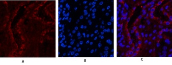 ERβ rabbit pAb Antibody