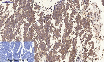 ERβ rabbit pAb Antibody