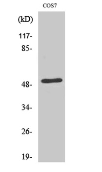 ETAR rabbit pAb Antibody