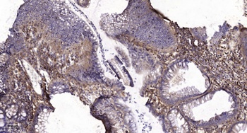 ETAR rabbit pAb Antibody