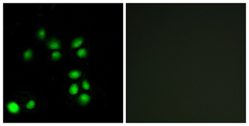 Exo1 rabbit pAb Antibody