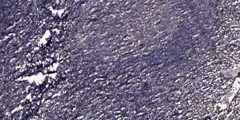 Factor VIII rabbit pAb Antibody