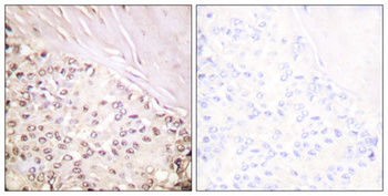 FANCD2 rabbit pAb Antibody