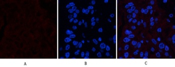 FAS rabbit pAb Antibody