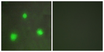 FAST-1/2 rabbit pAb Antibody