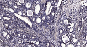 FASTKD2 rabbit pAb Antibody