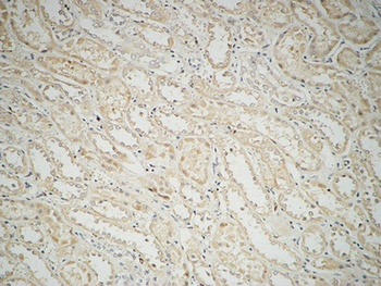 Fatty Acid Synthase rabbit pAb