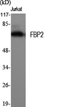 FBP2 rabbit pAb Antibody