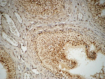 FEN-1 rabbit pAb Antibody