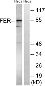 Fer rabbit pAb Antibody