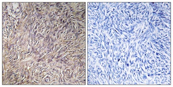 FGF-22 rabbit pAb Antibody