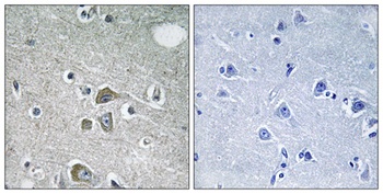Fibulin-2 rabbit pAb Antibody