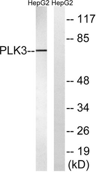 Fnk rabbit pAb Antibody