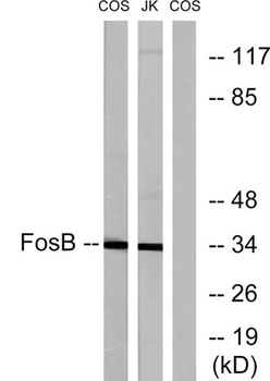 Fos B rabbit pAb Antibody