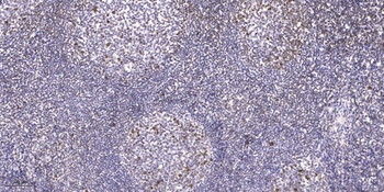 Fos B rabbit pAb Antibody