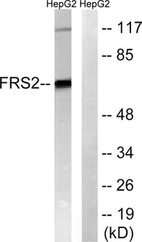 FRS2 rabbit pAb Antibody