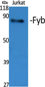 Fyb rabbit pAb Antibody