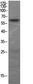 GAD-65/67 rabbit pAb Antibody