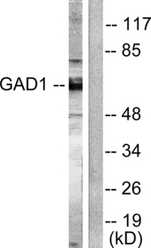 GAD-65/67 rabbit pAb Antibody