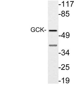 GCK rabbit pAb Antibody