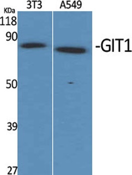 GIT1 rabbit pAb Antibody