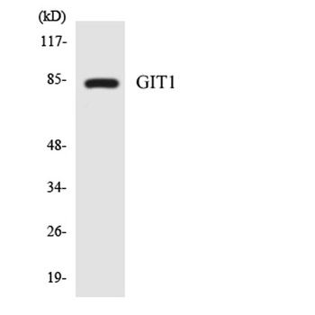 GIT1 rabbit pAb Antibody