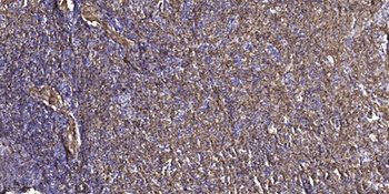 GIT1 rabbit pAb Antibody