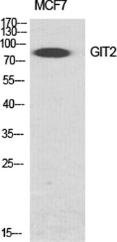 GIT2 rabbit pAb Antibody
