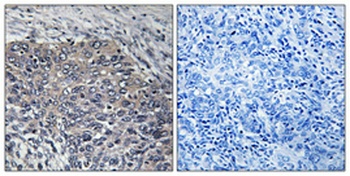 GIT2 rabbit pAb Antibody