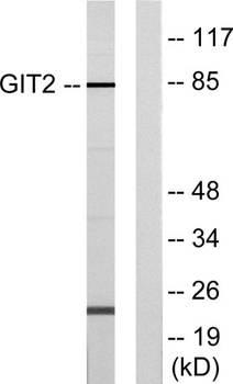 GIT2 rabbit pAb Antibody