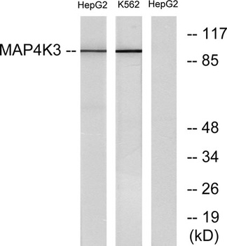 GLK rabbit pAb Antibody
