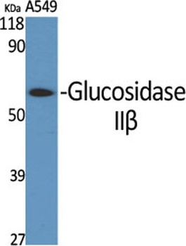 Glucosidase IIβ rabbit pAb Antibody