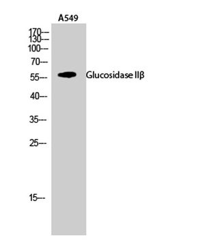 Glucosidase IIβ rabbit pAb Antibody