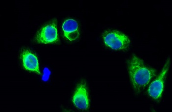 GluR-1 rabbit pAb Antibody