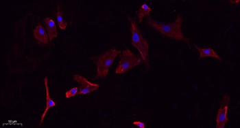 Glut1 rabbit pAb Antibody