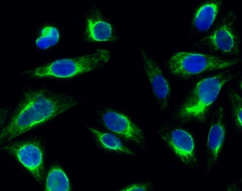 Glut1 rabbit pAb Antibody