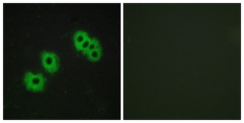 GPR105 rabbit pAb Antibody