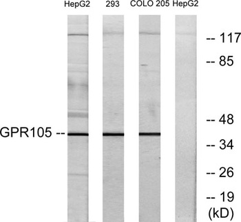 GPR105 rabbit pAb Antibody