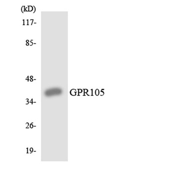 GPR105 rabbit pAb Antibody